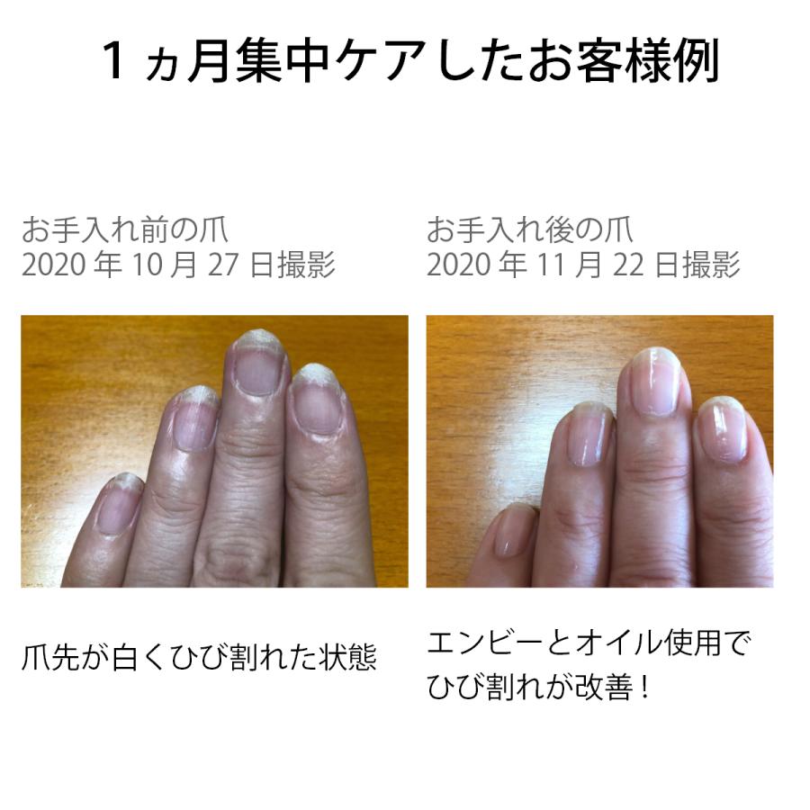 宅配送料無料 爪割れ防止ケアセット お得なトライアルセット Opi エンビー キューティクル オイル アセトンフリーリムーバー 強化剤 二枚爪 ネイルケア Tumeware Set4 マニキュア通販 大人ネイル 通販 Yahoo ショッピング