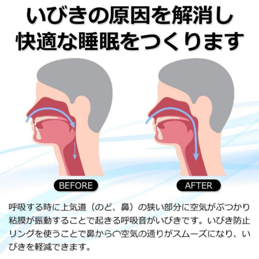 いびき 防止 リング 改善 軽減 対策 睡眠 安眠 グッズ 指輪 いびき+リング イビキ 防止 いびき防止グッズ いびき対策 睡眠グッズ 【Utiel】｜otsutome-store｜05