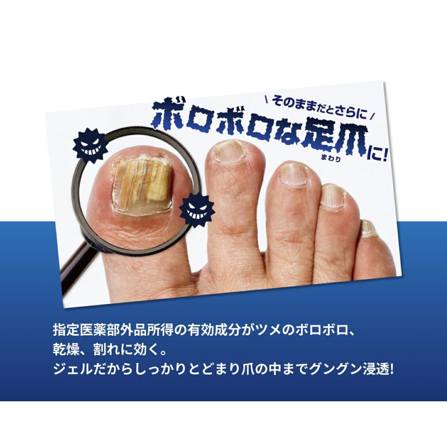 薬用足爪ジェル 足爪 ケア ジェル 薬用 殺菌 消毒 指定医薬部外品 爪の