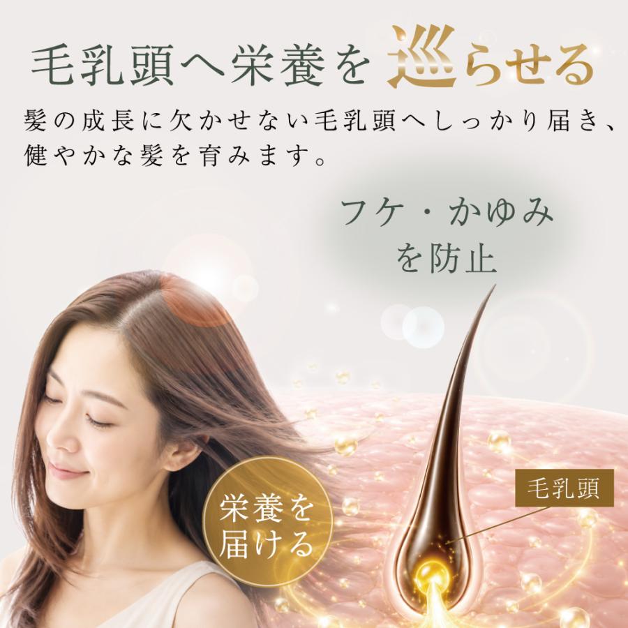 育毛剤 医薬部外品 日本製 髪 ハリ コシ ボリューム 生え際 分け目