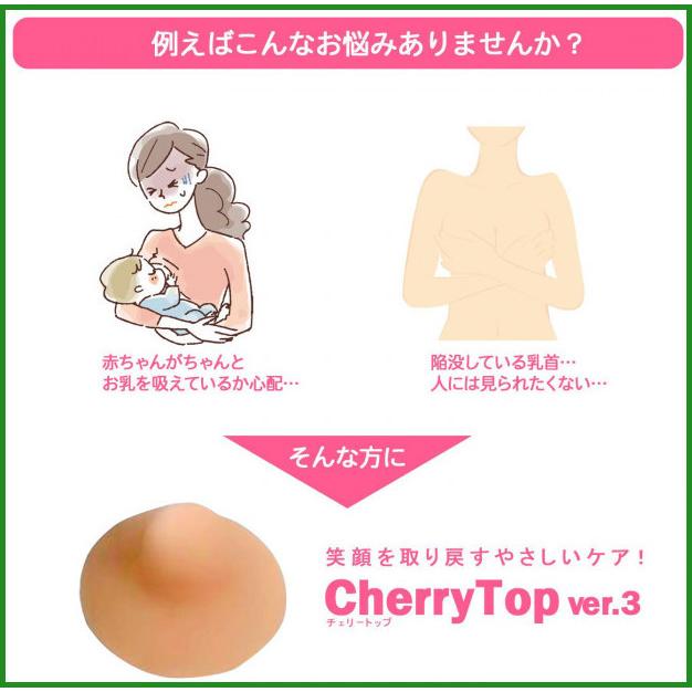税込 チェリートップiii 2個入 B03