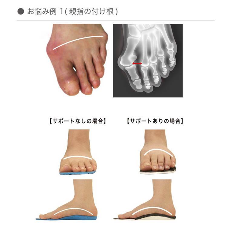 Dr.insole 3D オーダーメイド インソール メーカー直送 海外
