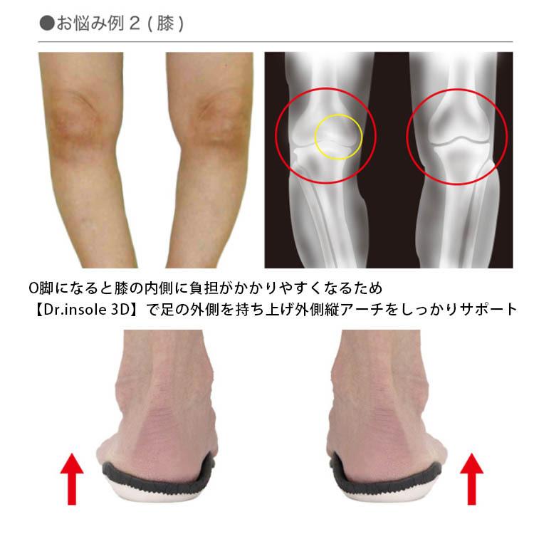 Dr.insole 3D オーダーメイド インソール メーカー直送 海外