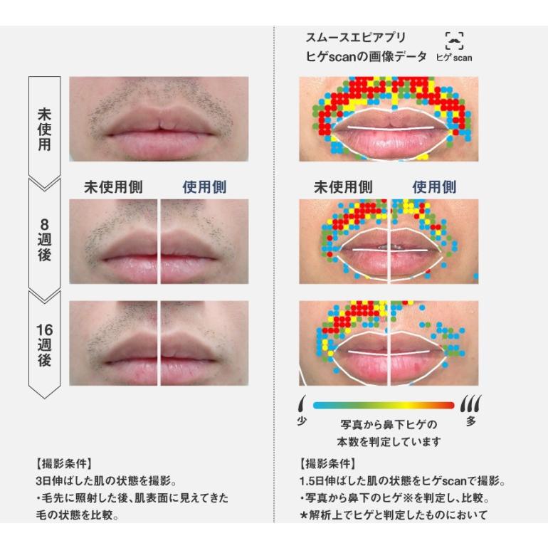 パナソニック 脱毛器 ES-WG0B-H  光エステ スムースエピ パワー＆クール グレー Panasonic  あすつく・即納・送料無料の画像
