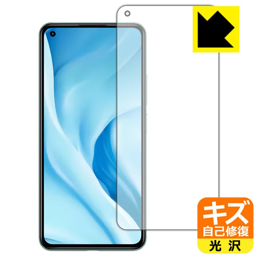 Mi Xiaomi 11 Lite 5G 自然に付いてしまうスリ傷を修復！保護フィルム