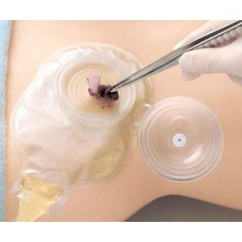 サージドレーンオープントップM 透明 平面 プレ キャップ式 滅菌済み