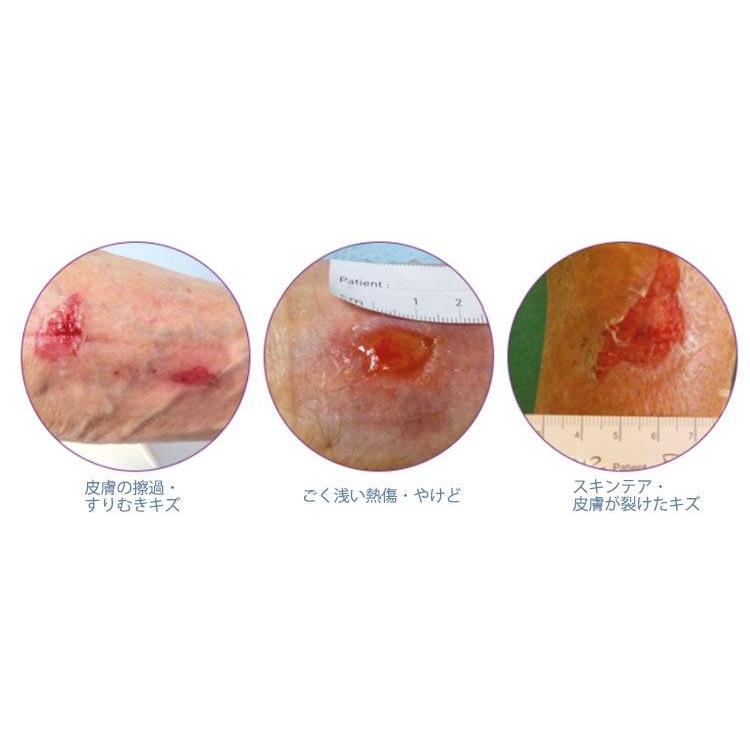 ふぉーむPro シリコーンフォーム 皮膚保護パッド 仙骨部用 20×16.9cm
