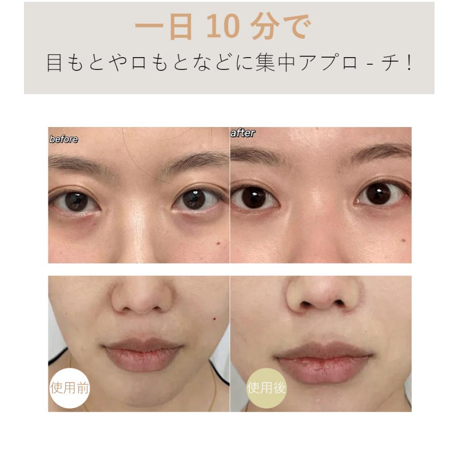 目元美顔器 目元ケア美顔器 美顔器 目元マッサージ 目元エステ 目元美顔器 目元ケア美顔器 美顔器 目元マッサージ 目元エステ