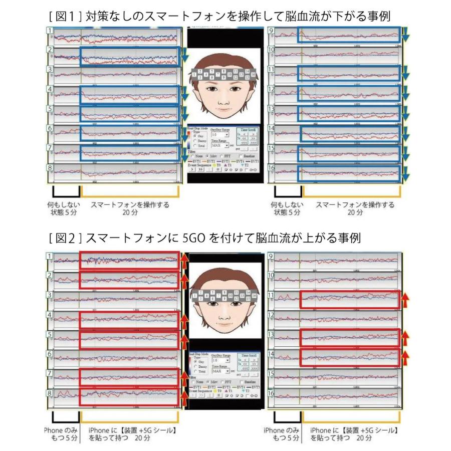 丸山式 電磁波ブロッカー ユニカ 電磁波対策 正規品 丸山式コイル 5GO Lightning ホワイト |  | 03