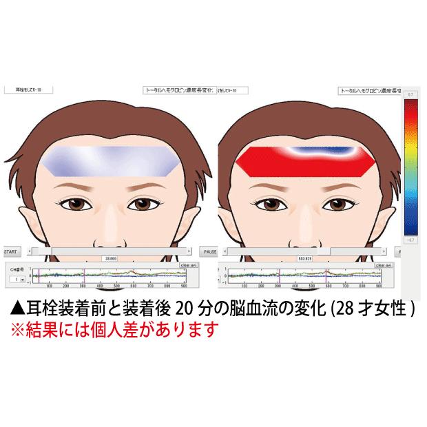 丸山式 ユニカ 電磁波対策 正規品 丸山式コイル 除電耳栓 ミミケア