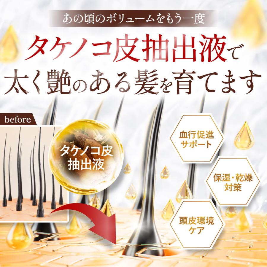 育毛剤 医薬部外品 女性用 120ml【ダブルの特殊技術採用】発毛促進