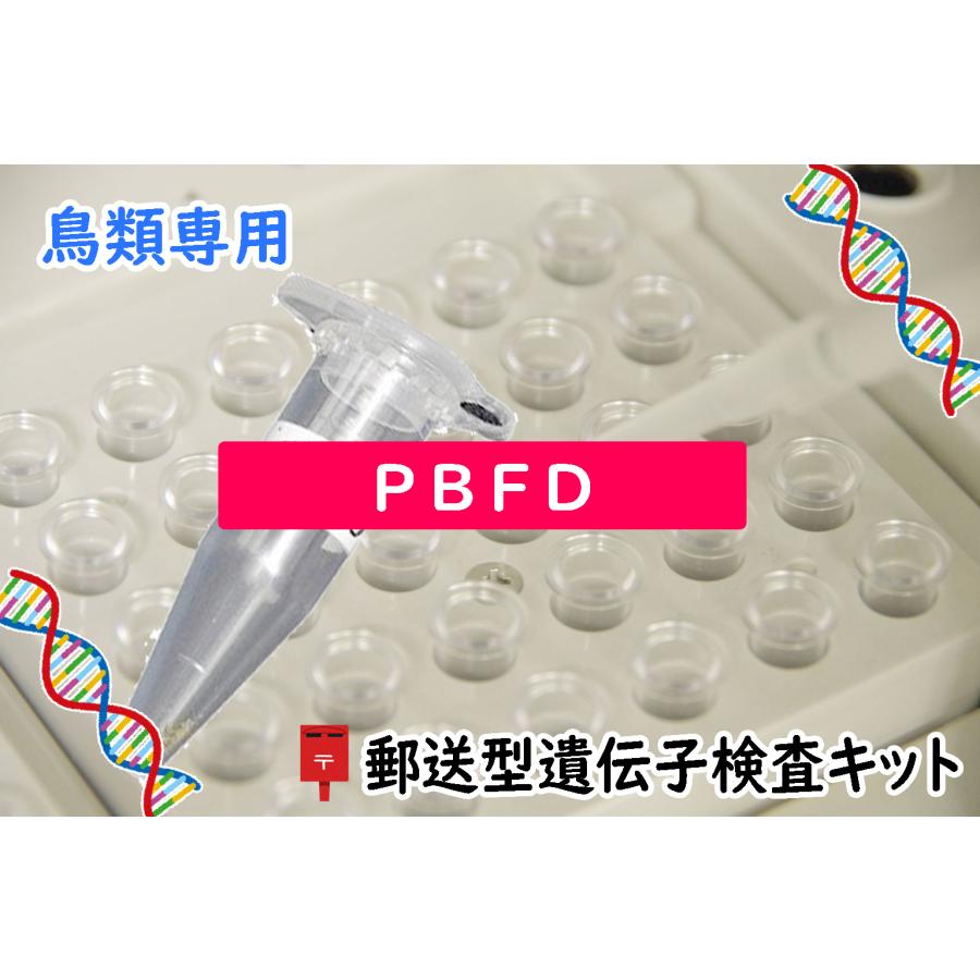 遺伝子検査キット Amazon | 遺伝子型ダイエット GeneLife 肥満遺伝子検査キット