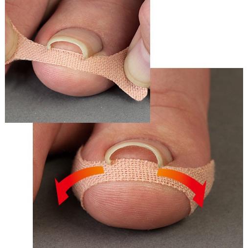 巻き爪テープ　くいこまーぬ　60枚入り　【メール便対応】　★ | サイプラス | 01