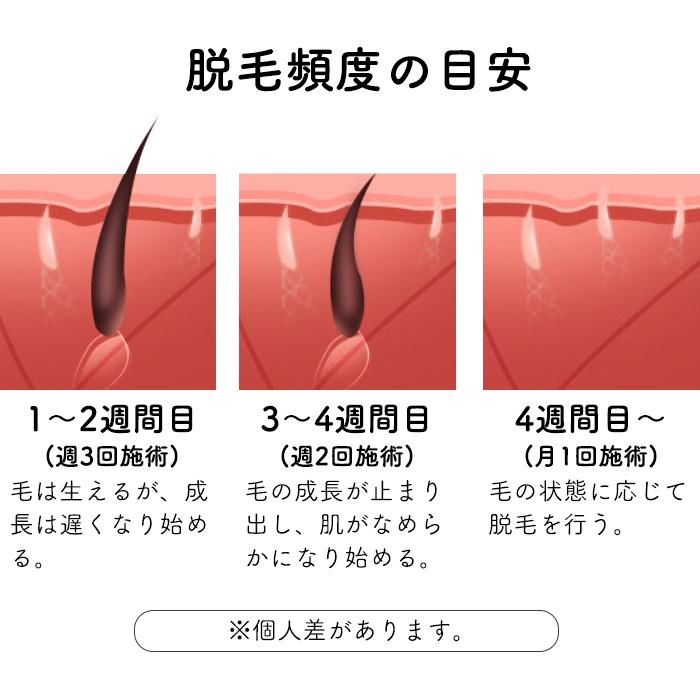 Folica］脱毛器家庭用脱毛器女性用男性用ジェル不要脱毛99万回照射ハイ