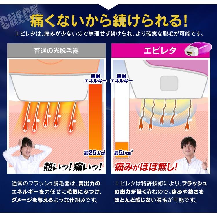 脱毛器　光脱毛　エピレタ　アイリスオーヤマ IRIS OHYAMA（アイリスオーヤマ） ヒゲ脱毛 メンズ 髭 脱毛 男性 家庭