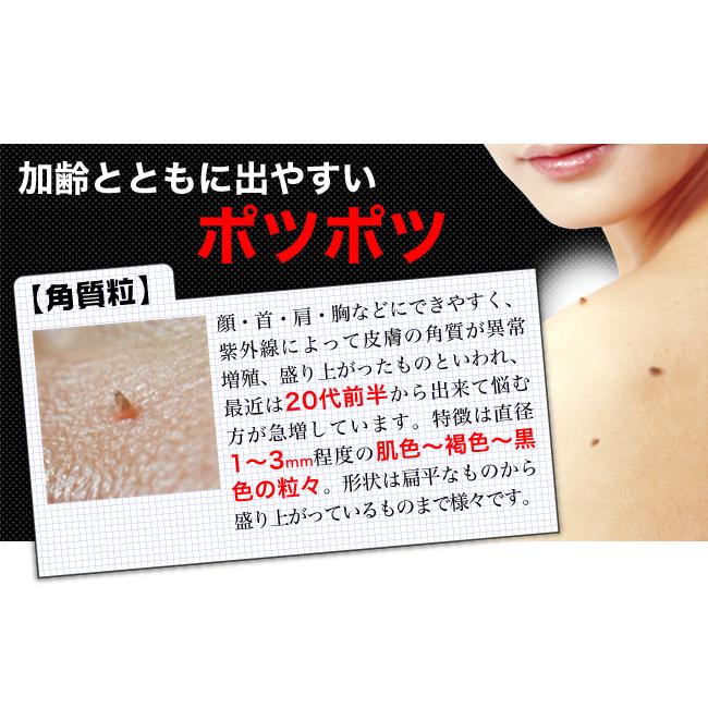 イボ取り イポケアEX 18ml イボ いぼ 美容液 角質ケア ヨクイニン 角質粒 スキンケア 首筋 胸元 イボ ポツポツ | ブレーンコスモス | 02