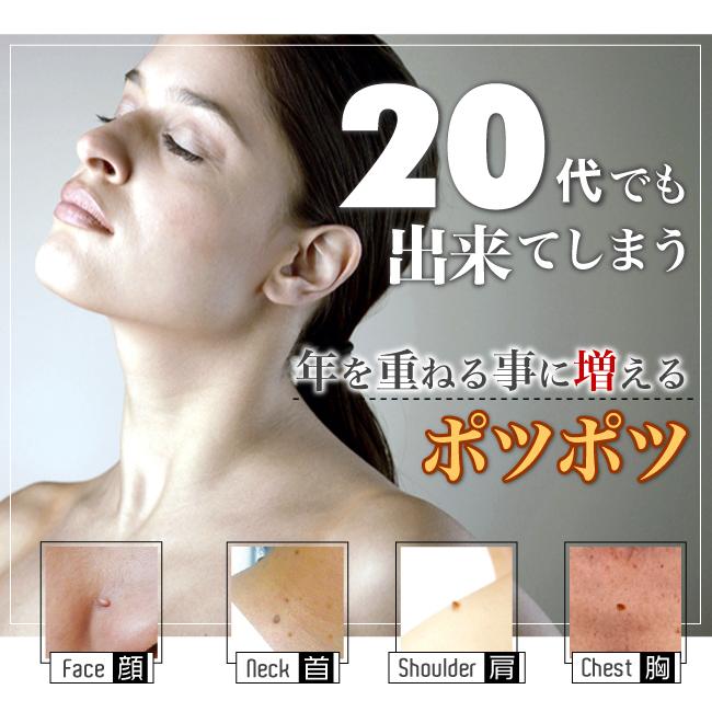 イボ取り イポケアEX 18ml 2個セット イボ いぼ 美容液 角質ケア ヨクイニン 角質粒 スキンケア 首筋 胸元 イボ ポツポツ | ブレーンコスモス | 04