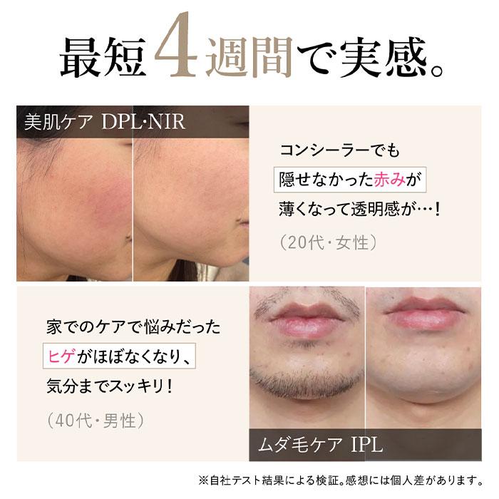 WAVEWAVE ラディアント グレイス Radiant Grace ムダ毛ケア 美肌ケア リフトケア IPL DPL NIR 照射 30万発 送料無料 正規品 女性 男性 サロン 家電 | WAVEWAVE | 02