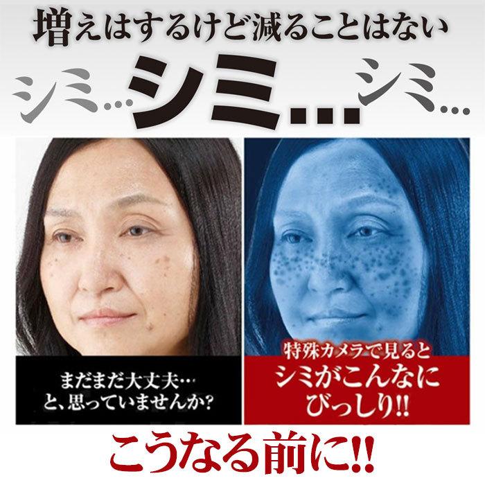 シミ 黒ずみ シミケア 【薬用クロパックン プレミアム 30g】医薬部外品