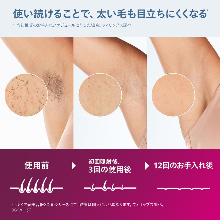 光美容器 フィリップス ルメア 光美容器8000 BRI940/70 シルバー_3