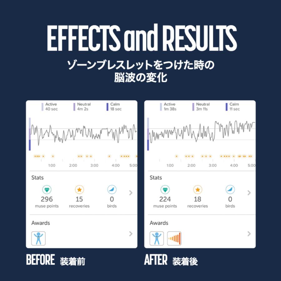 正規代理店・30日返金保証｜ゾーンブレスレット フィリップ