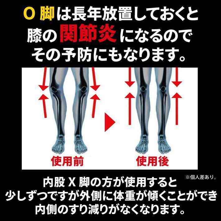 PhoenixSole 理学療法士監修 インソール X脚 O脚 用 美しい I脚に