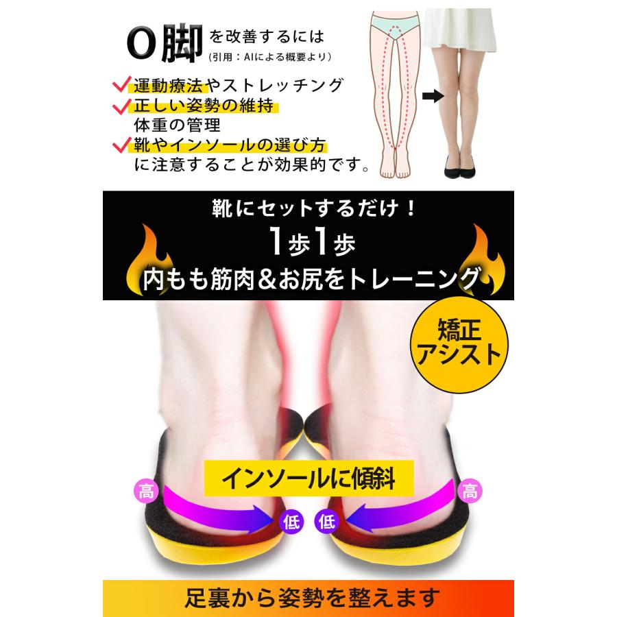 PhoenixSole 理学療法士監修 o脚矯正 インソール o脚 x脚 矯正 グッズ