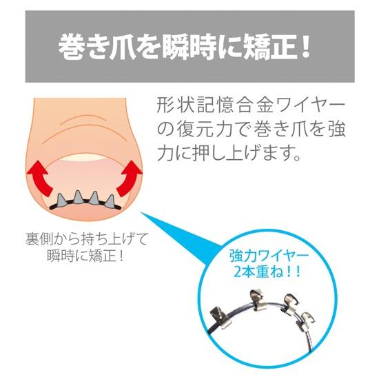 巻き爪リフト 2個セット まきづめ まき爪 弾力性ワイヤーで瞬時