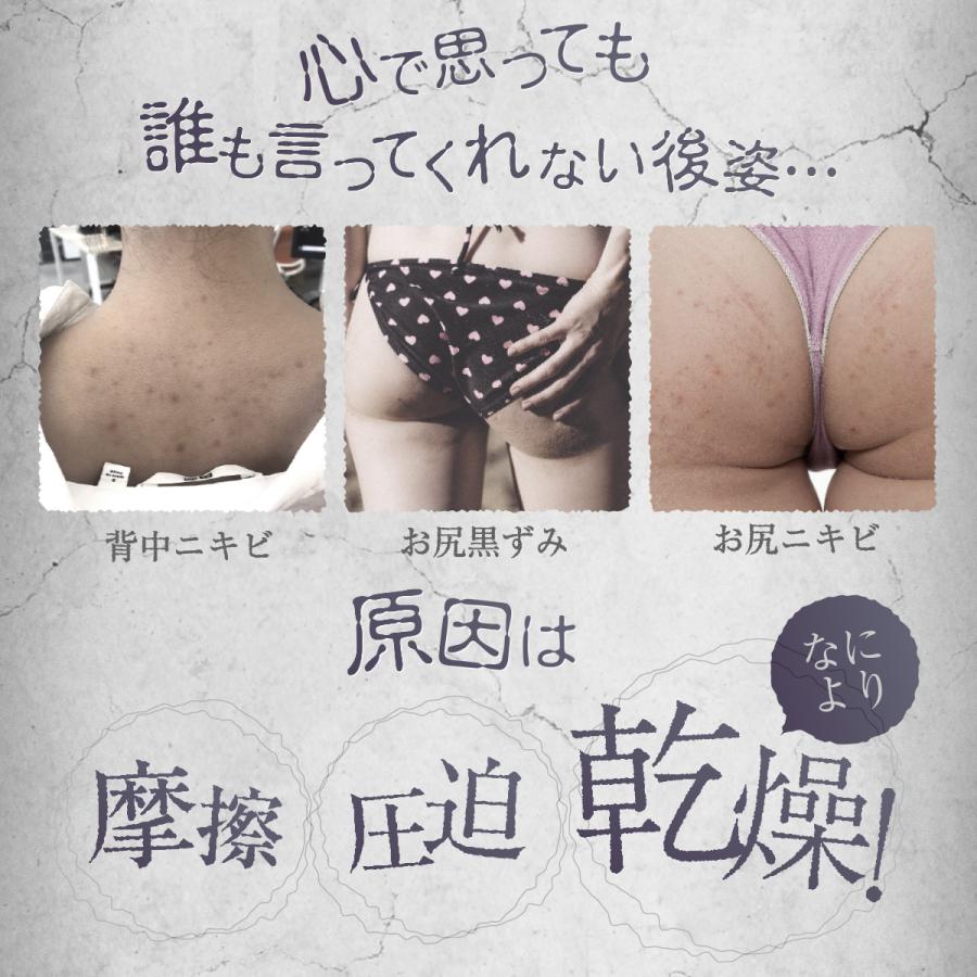 ピカイチ 背中ニキビ ニキビ 保湿 薬用 ボディジェル 公式 ジュエル