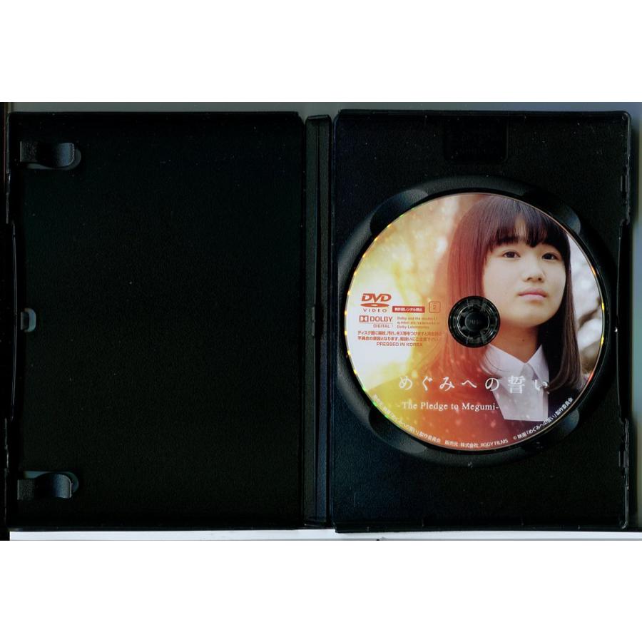 めぐみへの誓い The Pledge to Megumi/DVD 中古 レンタル落ち/c5398 | ブランド登録なし | 01