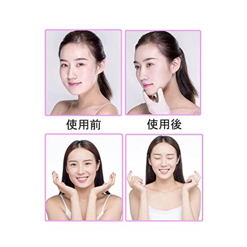 YINKE 小顔テープ リフトアップテープ 顔リフトアップ 強力 ほうれい線