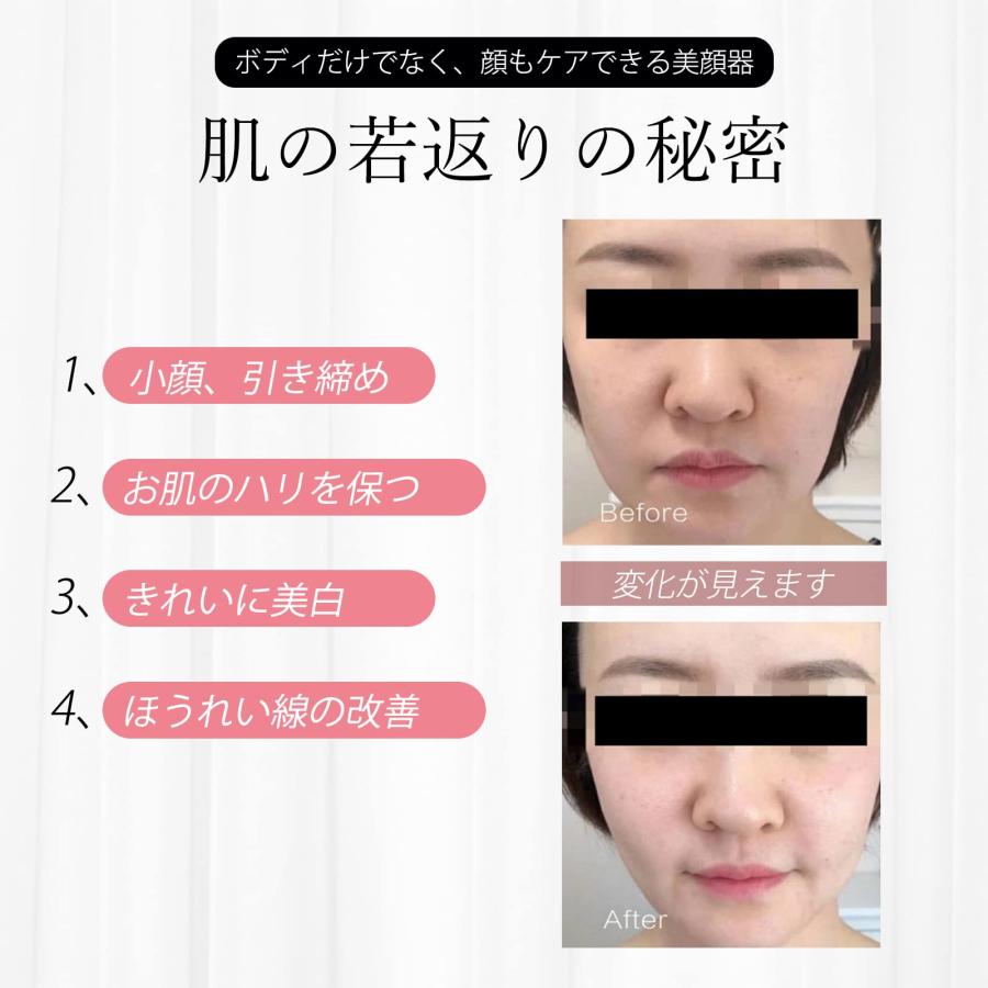 フェイシャル LEDライト RF 肌引き締め 若返り 美容機器