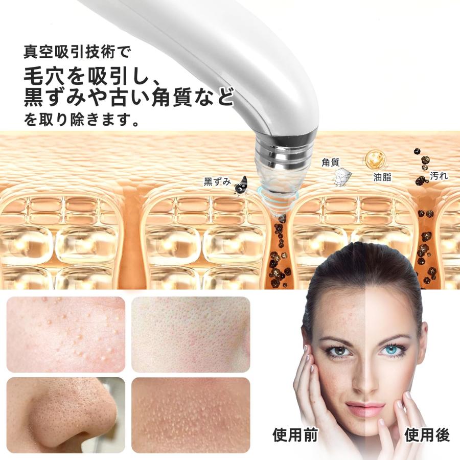 ☆大幅値下げ☆　bijou　毛穴洗浄 ☆大幅値下げ☆ bijou 毛穴洗浄