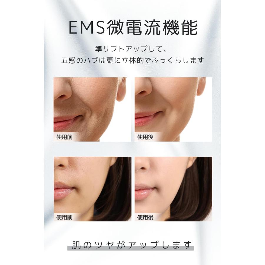 sumiren 美顔器 EMS美顔器 EMS 多機能美顔器 高周波美顔器 RF sumiren 美顔器 EMS美顔器 EMS 多機能美顔器 高周波美顔器 RF