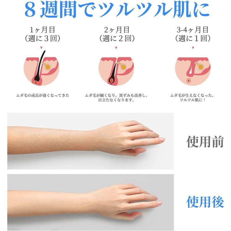 信頼Ni Zmir サファイア冷感脱毛器 男女兼用 九段階調節 自動照射 VIO