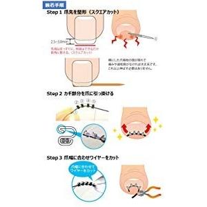 Newまきづめリフト 2個セット 爪やすり付き 巻き爪矯正 送料無料 Ml4sf02 Plaza De Beaute 通販 Yahoo ショッピング