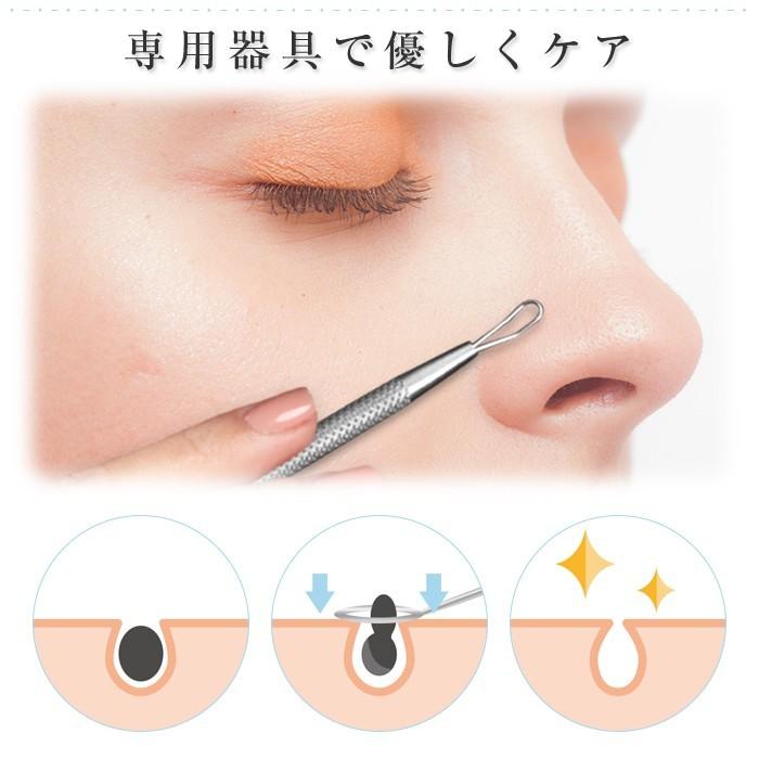 黒ニキビ ニキビケア にきびケア 角栓取り スティックセット ピンセット 角栓 鼻 毛穴 角栓スポットステック 小鼻のお手入れ 汚れ くすみに フェイスケア |  | 01