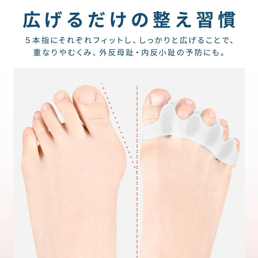 ♪ 外反母趾 パッド 内反小趾 パッド 足指サポーター 足指広げる 足指開き Amazon | 内反小趾 外反母趾 足指 パッド 小指サポーター 内反小