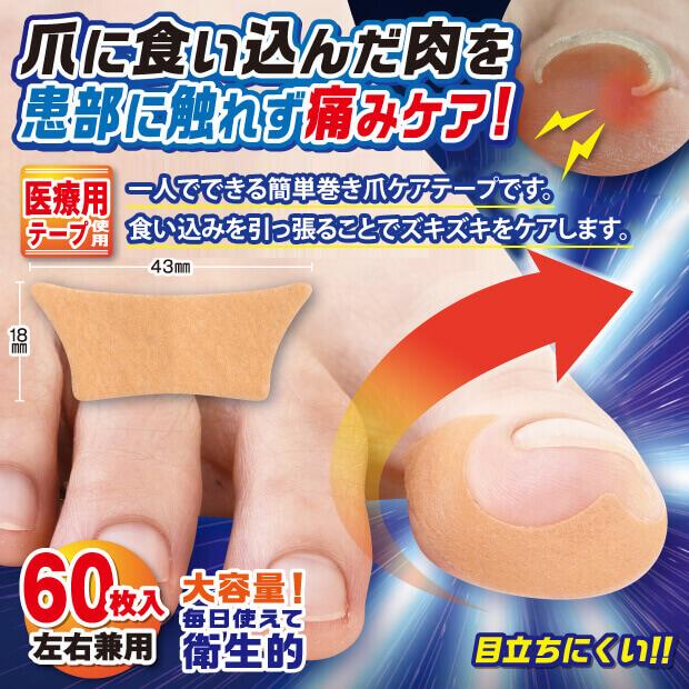 巻き爪テーピングサポートＥＸ 足指の気になる巻き爪部分にテーピングのように巻きつけるだけ 巻き爪 テープ 巻き爪ケアテープ |  | 01
