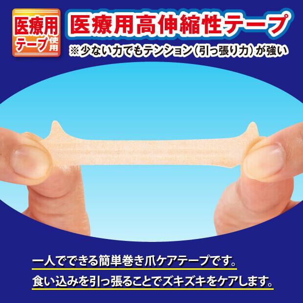 巻き爪テーピングサポートＥＸ 足指の気になる巻き爪部分にテーピングのように巻きつけるだけ 巻き爪 テープ 巻き爪ケアテープ |  | 02