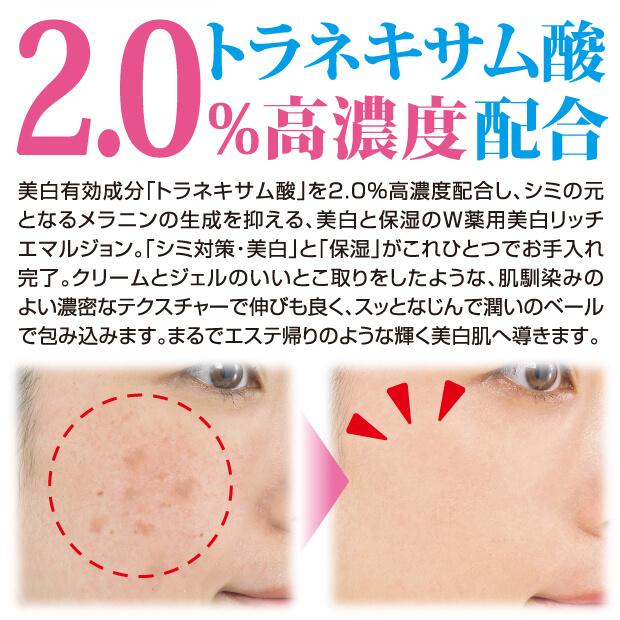 薬用トラシーミM 医薬部外品 オールインワンリッチエマルジョン |  | 02