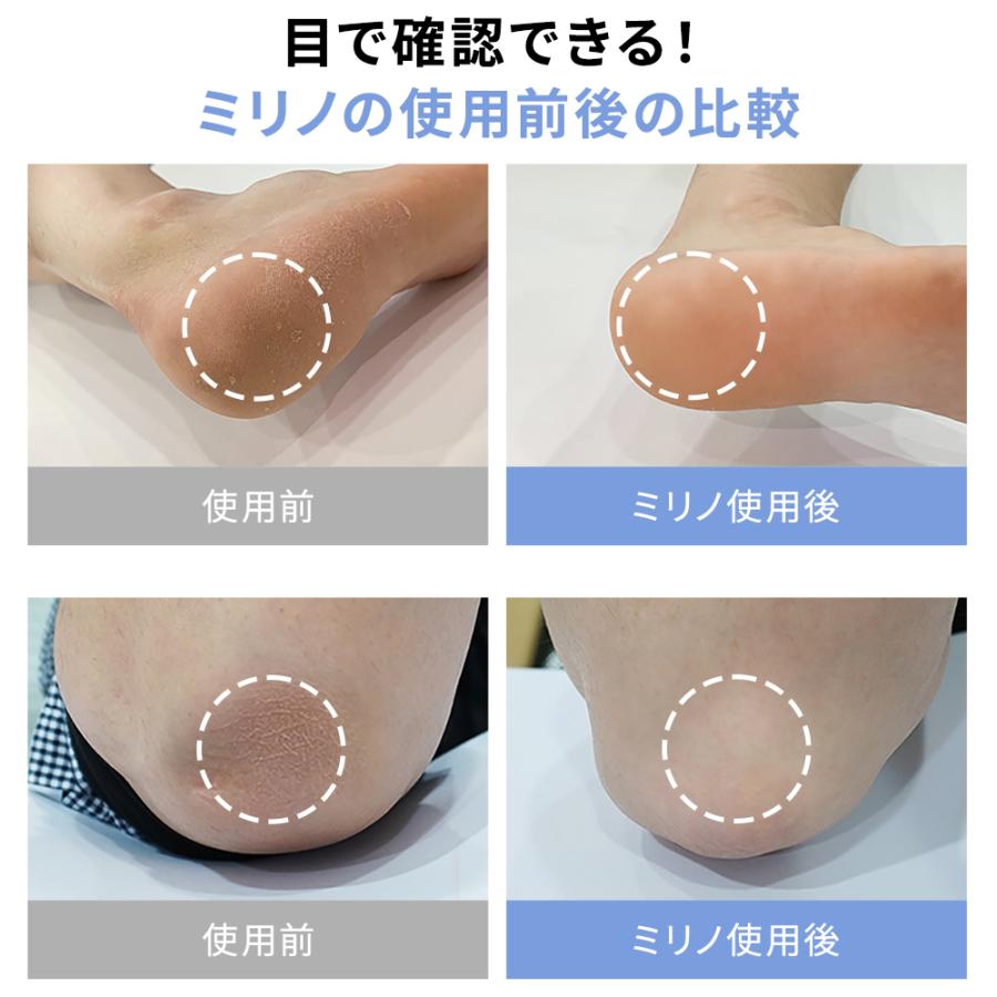 ミリノあかすりタオル 垢すり ビューティー 便利グッズ リラックス バス お風呂 美容 バスグッズ サウナ タオル グローブ アカスリタオル |  | 12