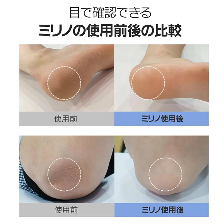 ミリノあかすりグローブ 両手1セット 垢すり ビューティー 便利グッズ バス お風呂 美容 バスグッズ サウナ タオル グローブ ミリノ あかすりグローブ |  | 09