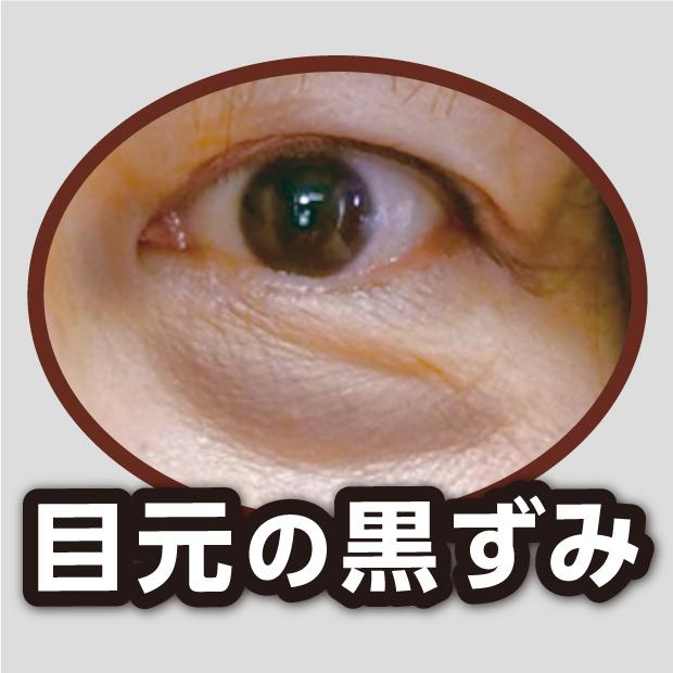 アカラナインG お肌の悩みをしっかりケア、カバー |  | 02