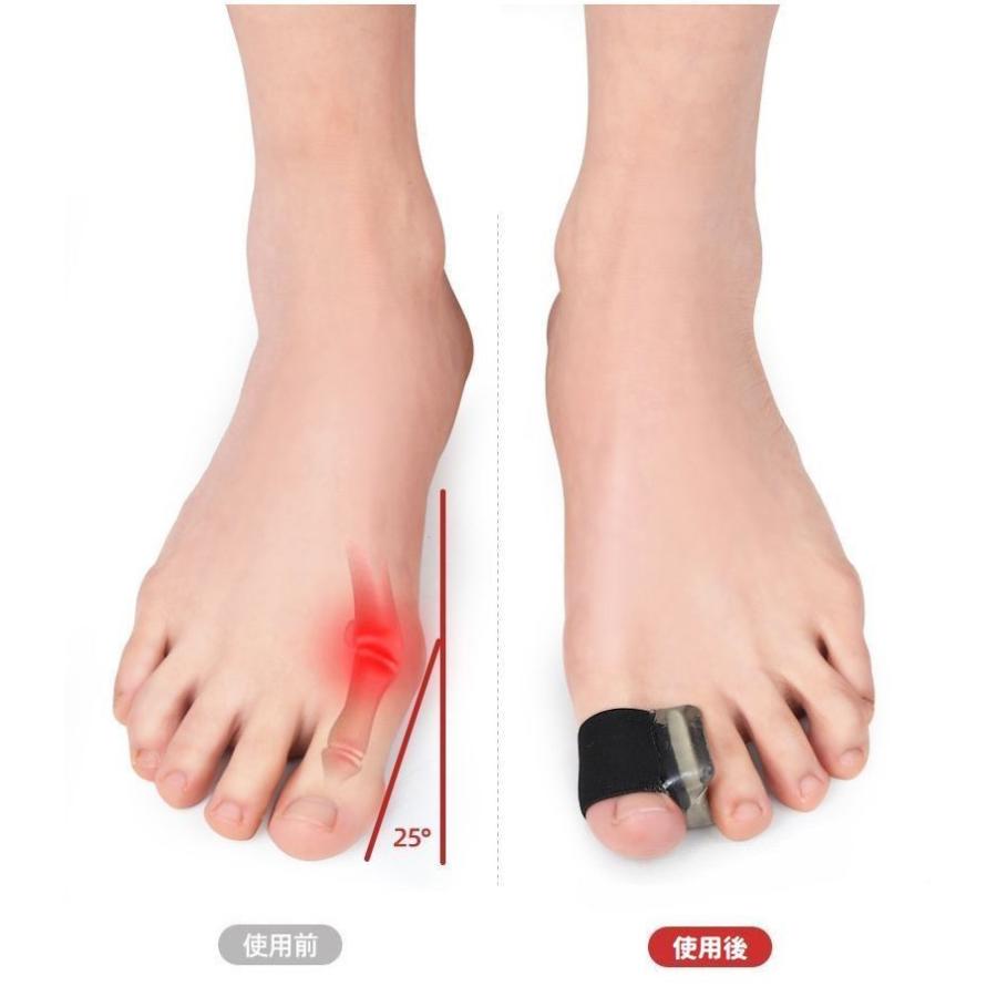 plusnao（プラスナオ） 指サポーター 足指用 同色2個セット ペア