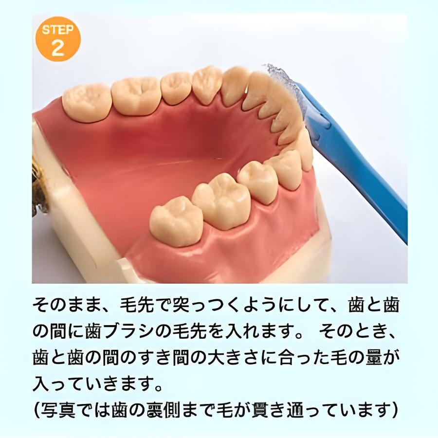 【公式】V7お試しセット2本組「つまようじ法」歯ブラシ　キャップ付　歯周病 歯間ブラシ 歯ぐきマッサージ 送料無料 pmj | ピー・エム・ジェー | 05
