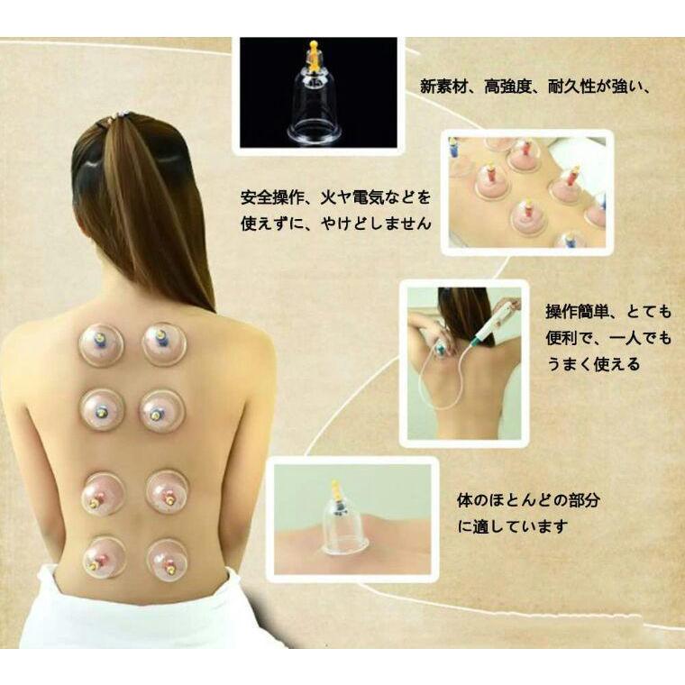 吸い玉 吸玉 6個 セット 肩こり 解消 グッズ 背中 マッサージ 真空ポンプ 於血 汚血 瀉血 東洋医学 血液 血行 美容 健康カッピング 経絡図 つぼ 生活習慣病 :BHG00003:ポケットミートショップ - 通販 - Yahoo!ショッピング 吸い玉 吸玉 6個 セット 肩こり 解消 グッズ 背中 マッサージ 真空ポンプ 於血 汚血 瀉血 東洋医学 血液 血行 美容 健康カッピング 経絡図 つぼ 生活習慣病 :BHG00003:ポケットミートショップ - 通販 - Yahoo!ショッピング