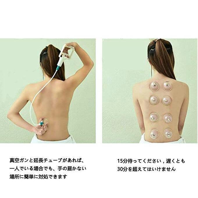 一部予約 つぼ 健康カッピング 瀉血 吸い玉 生活習慣病 背中 セット マッサージ 於