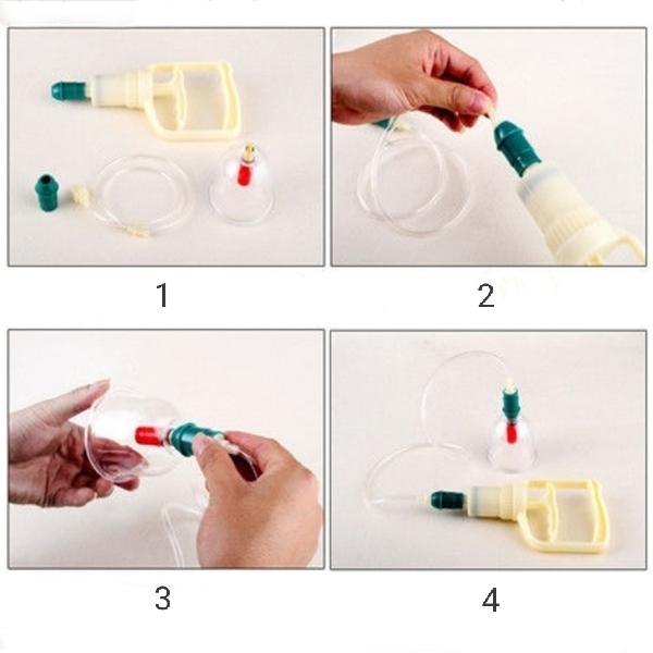 一部予約 つぼ 健康カッピング 瀉血 吸い玉 生活習慣病 背中 セット マッサージ 於
