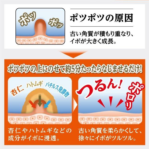 glim(グリム) イポロンC スキンケア 美容 杏仁 ハトムギ 酵素 イボケア